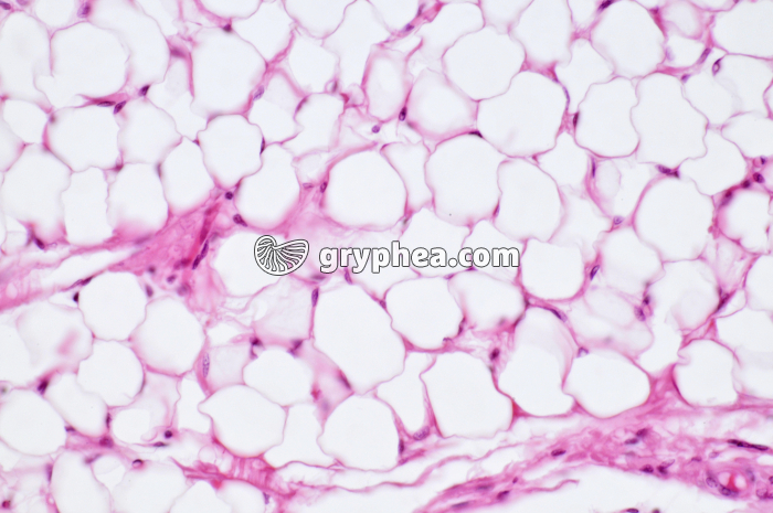 Tissu adipeux CT x100 - gryphea.org